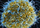 Ebola Outbreak Sparks Global Alarm; 80 Dead as WHO Declares Public Health Emergency. Vi