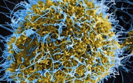 Ebola Scare at Jaipur Airport: Ugandan Woman Isolated at RUHS Hospital.