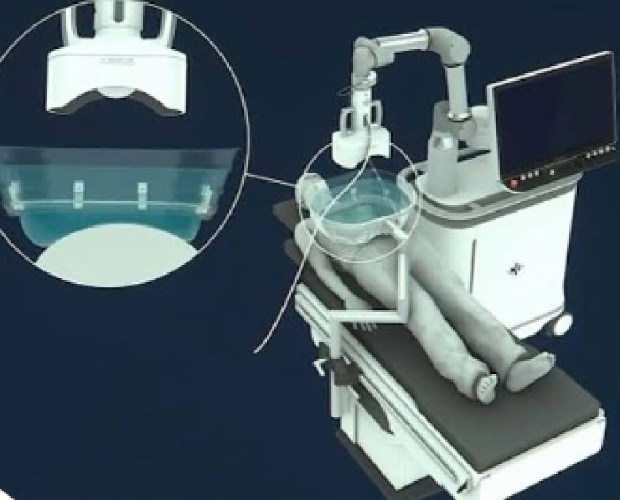FDA-Approved 'Histotripsy' Destroys Tumors With Sound and Water — No Scalpel, No Radiation, No Recovery Time.