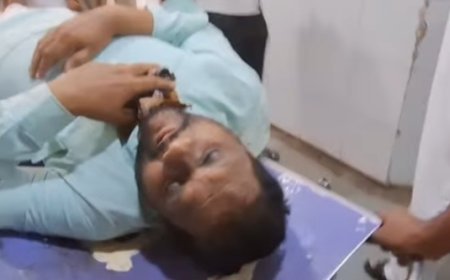 Attack on Islam Party’s Aurangabad City Vice-President Azhar Pathan Sparks Concern